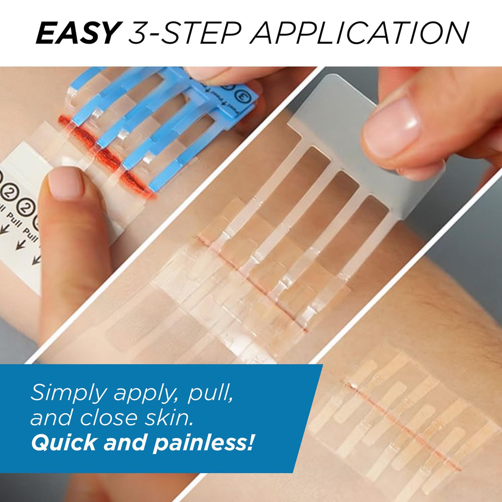 Clozex cover bandage protects the closed wound during healing.