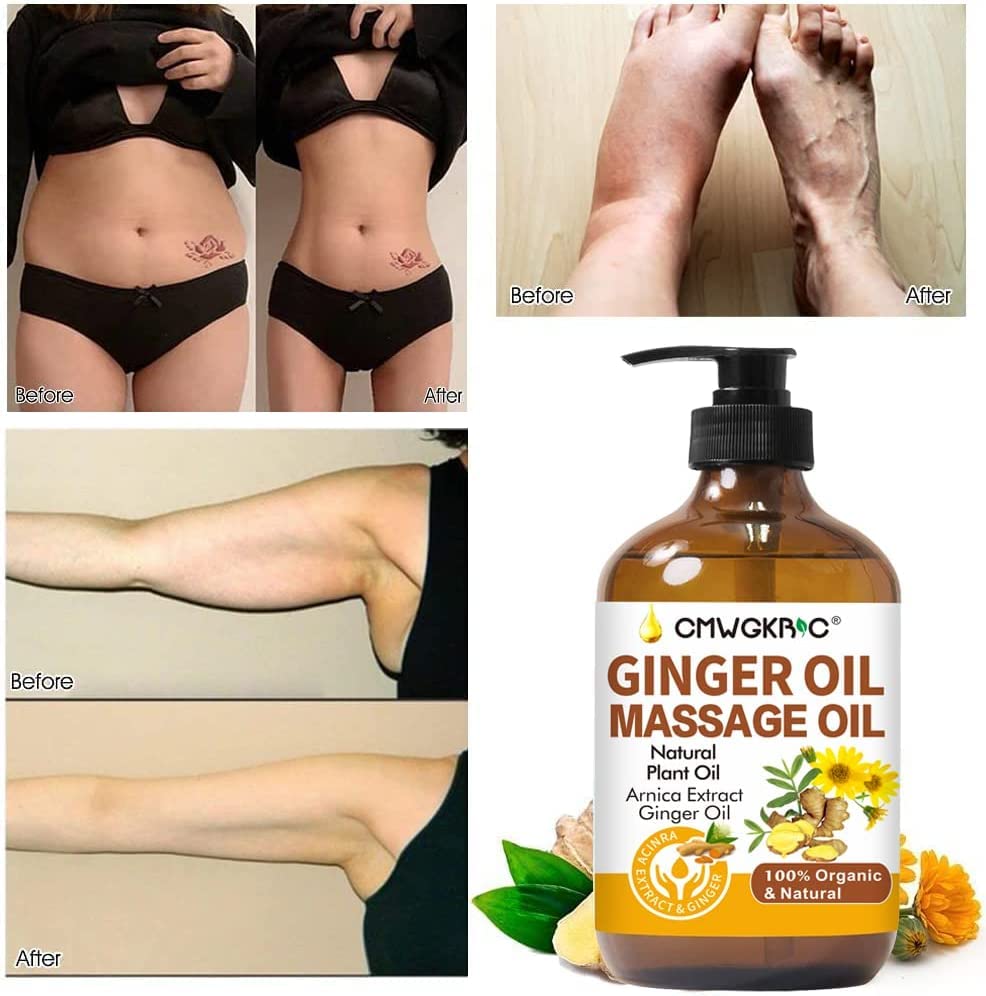 CMWGKBC arnica-ginger oil highlights natural ingredients for skin care.