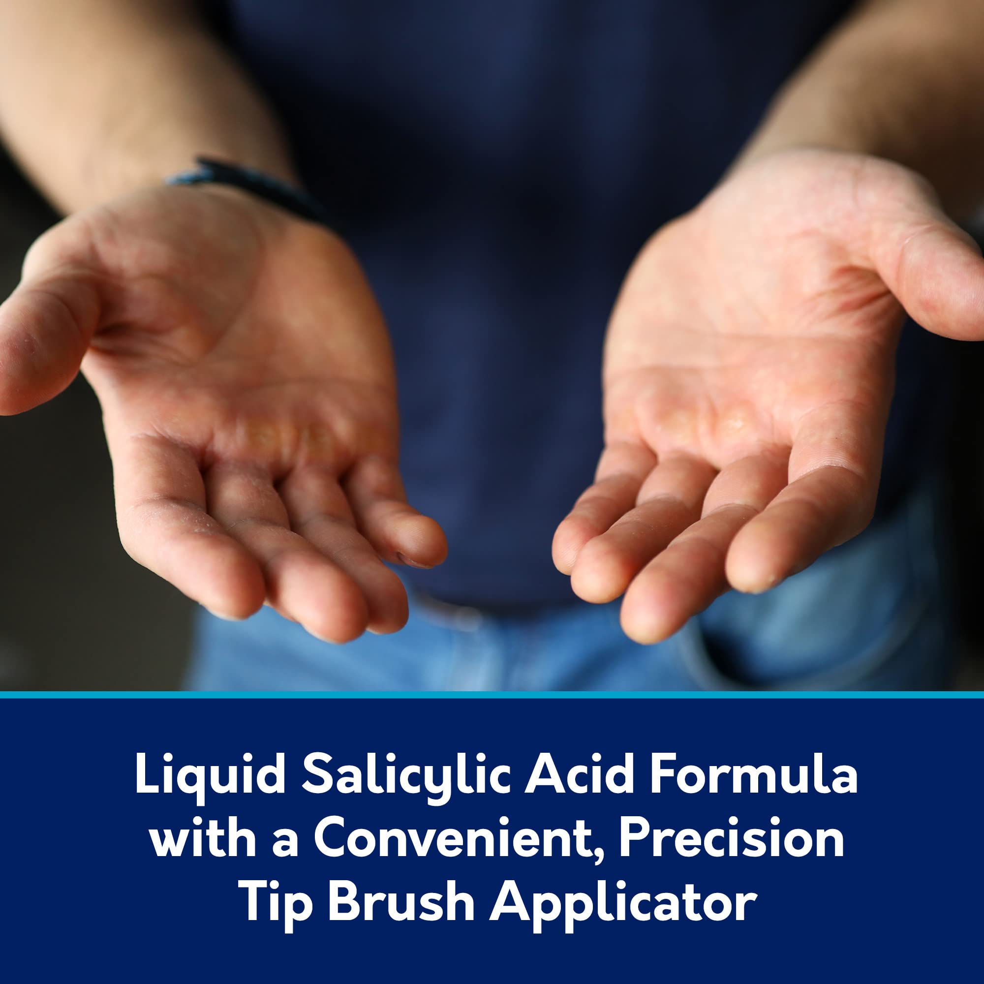 Closeup of Compound W bottle and brush for targeted wart treatment