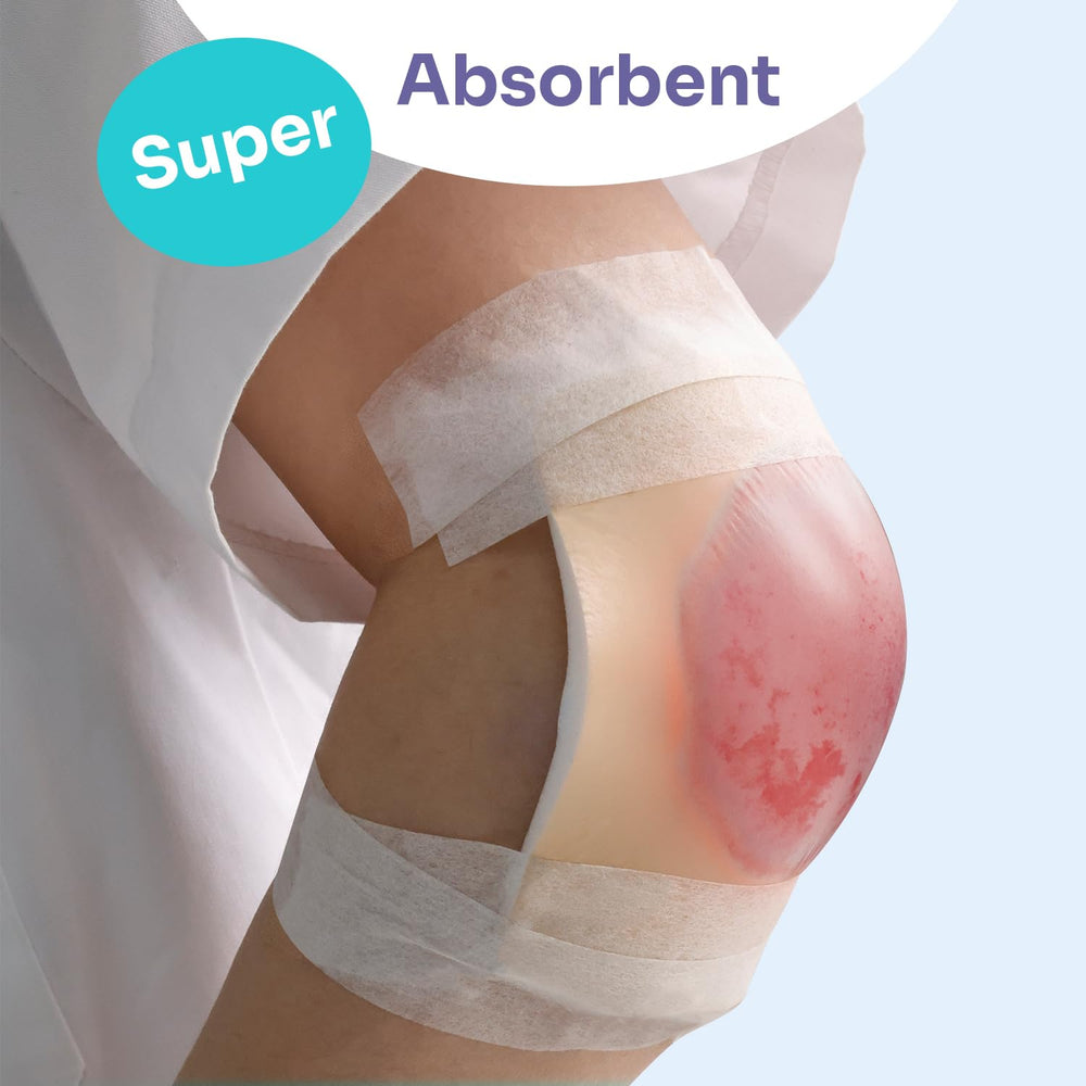 Conkote individually packaged foam dressings ensure clean, ready-to-use care