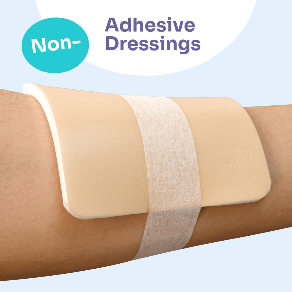 Conkote non-adhesive sterile wound pads stay secure without sticking