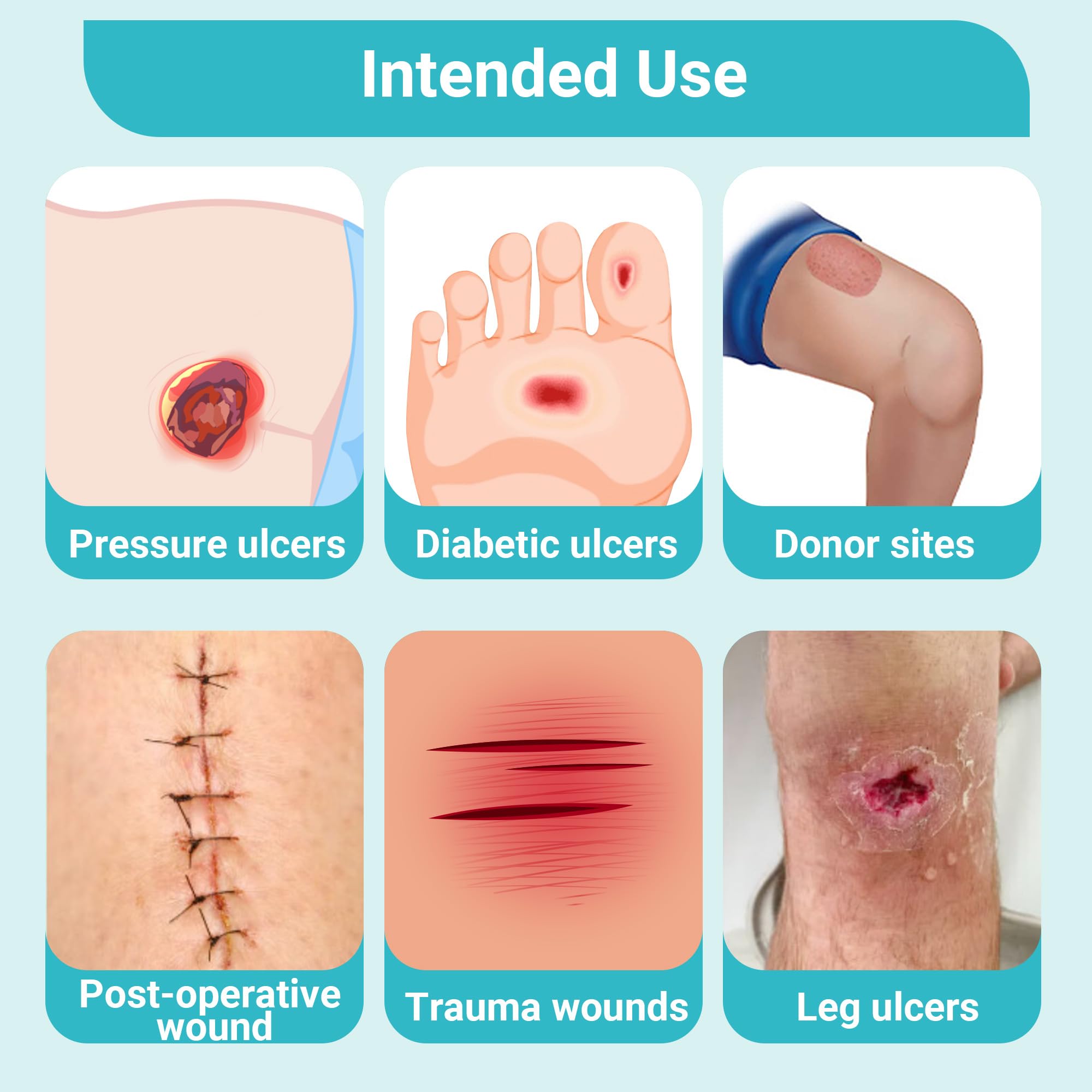 Conkote Silver Alginate Pad ideal for diabetic ulcers and similar wounds