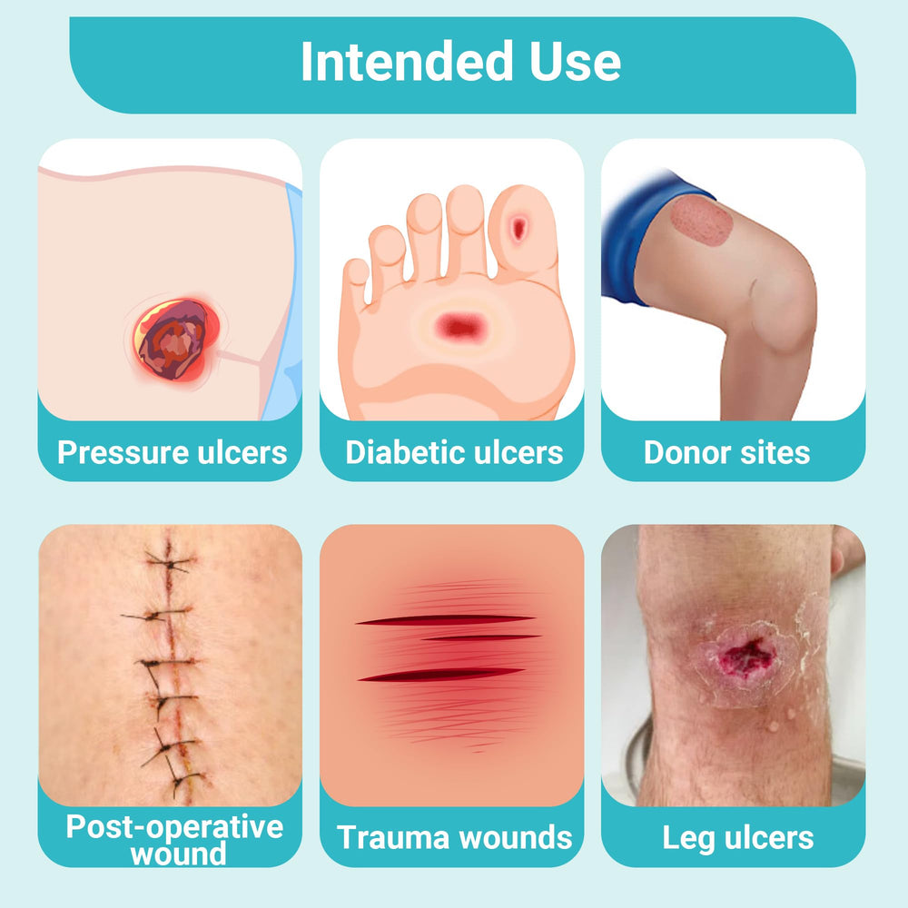 Conkote Silver Alginate Pad ideal for diabetic ulcers and similar wounds