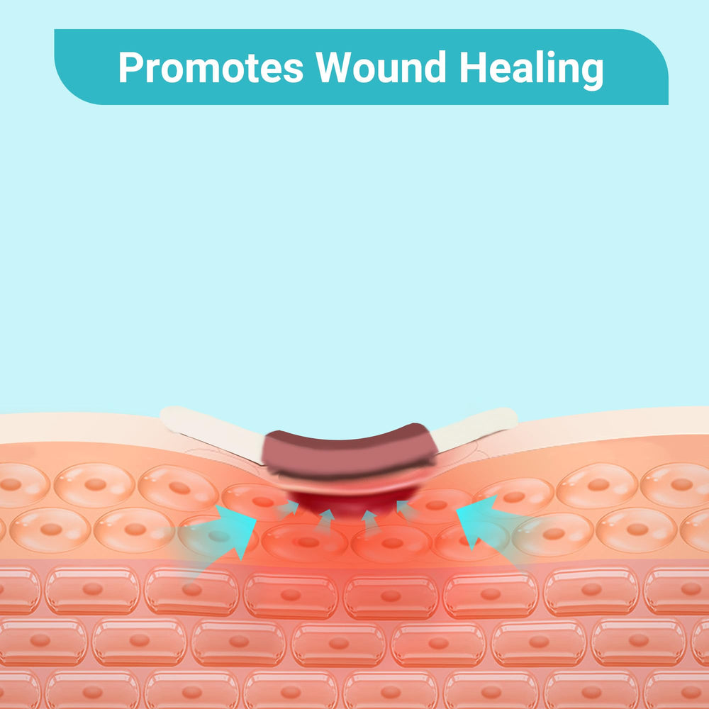 Conkote Silver Alginate Pad for pressure ulcers and other exudating wounds