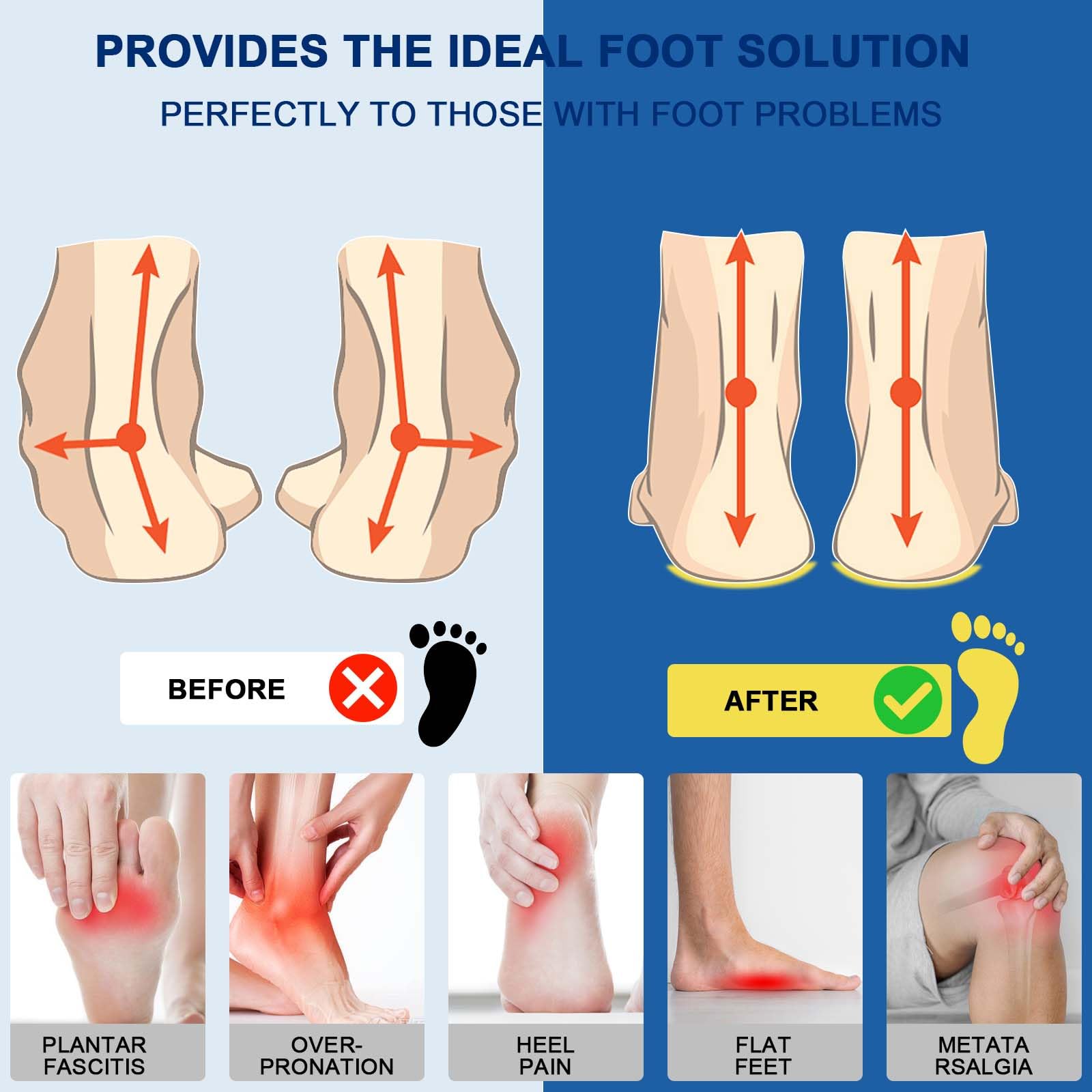 Crinova soft forefoot foam and gel for comfortable all-day wear