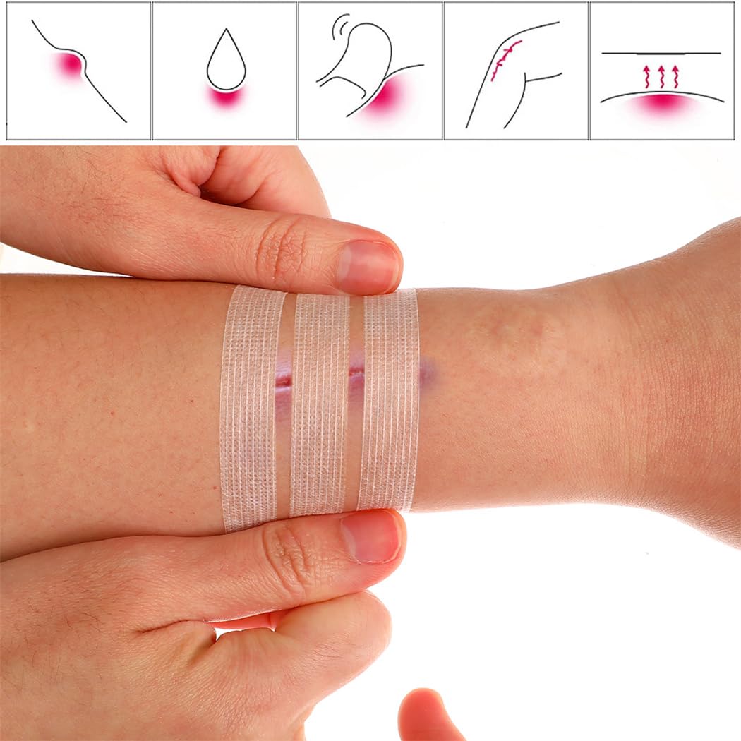 CUNQN latex-free wound closure tape emphasizes skin-friendly use.