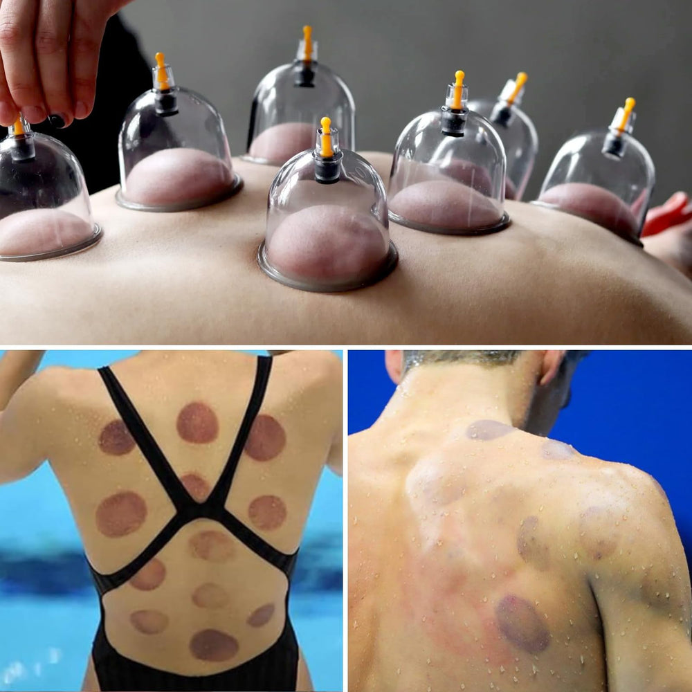 Cupluw gift-ready cupping set, a thoughtful wellness gift