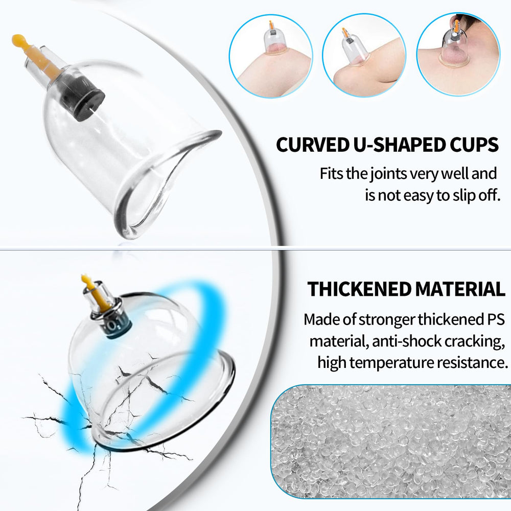 Cupluw magnetic points support targeted acupoint-like stimulation.