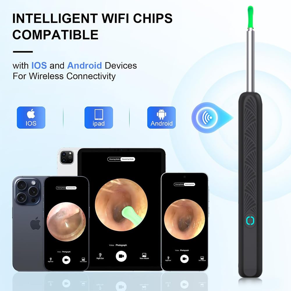 CZYJPRL traditional ear scoop kit for versatile ear care.