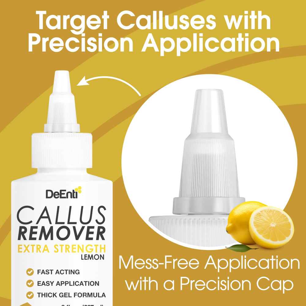 DeEnti callus remover in use for quick five-minute relief