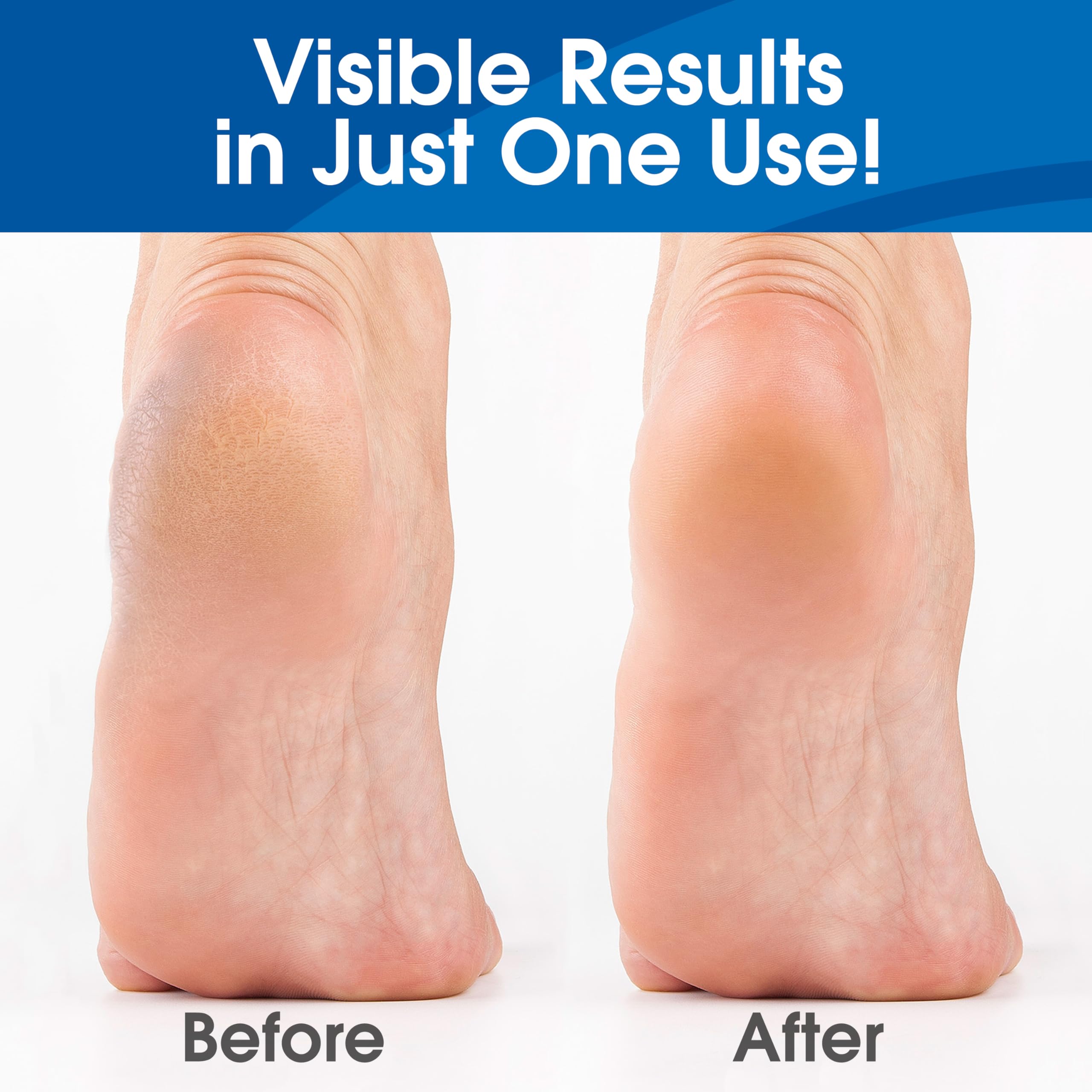 Thick no-drip gel texture ready to soften rough skin.