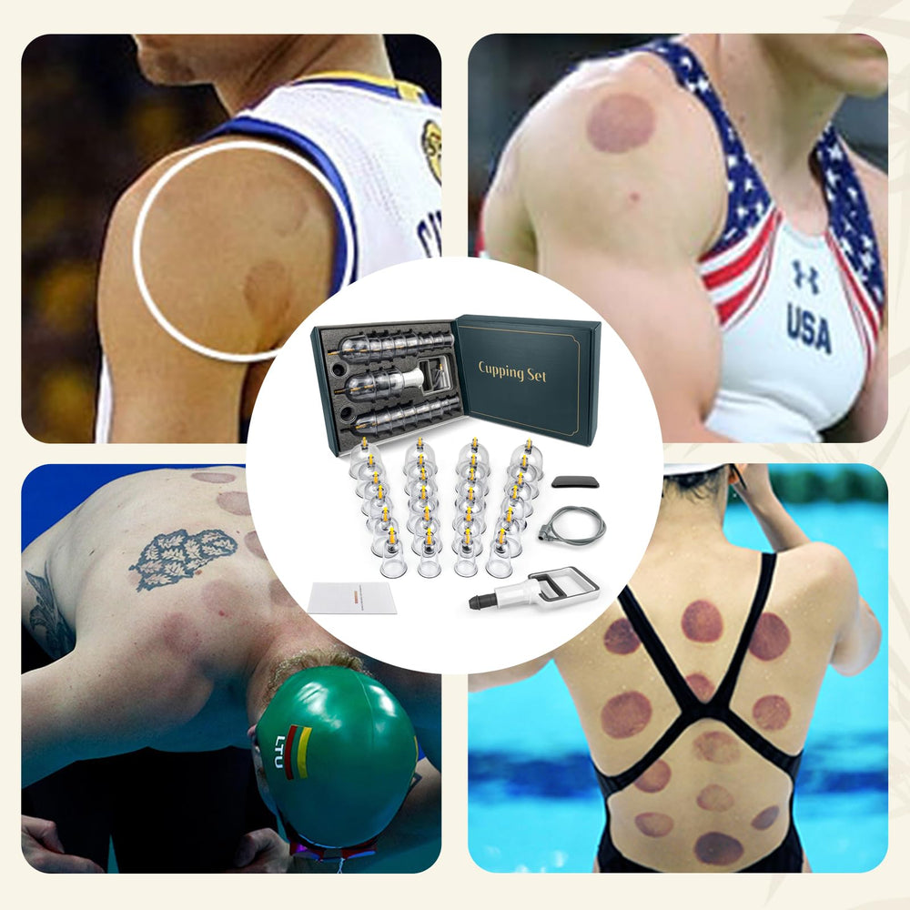 DEFUNX hijama cupping kit with U‑shape cups for contoured areas.