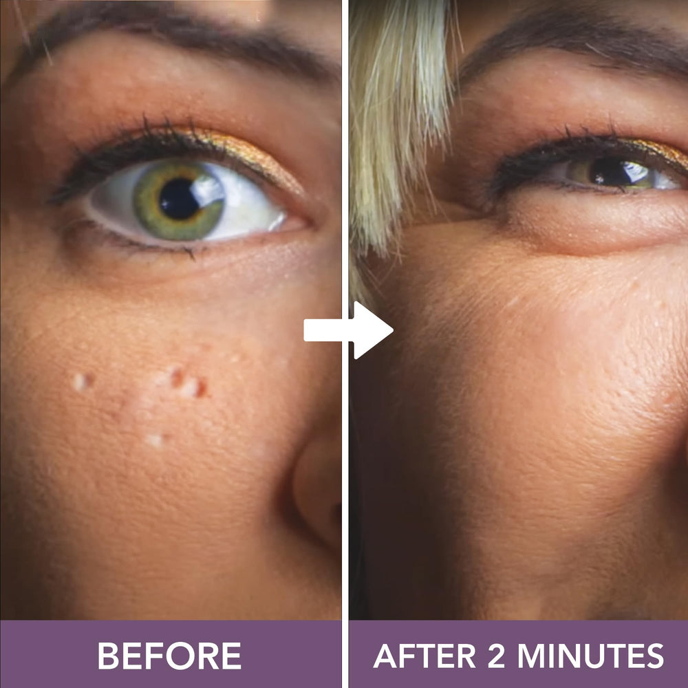 Full Coverage Concealer Palette offers color correction for redness.