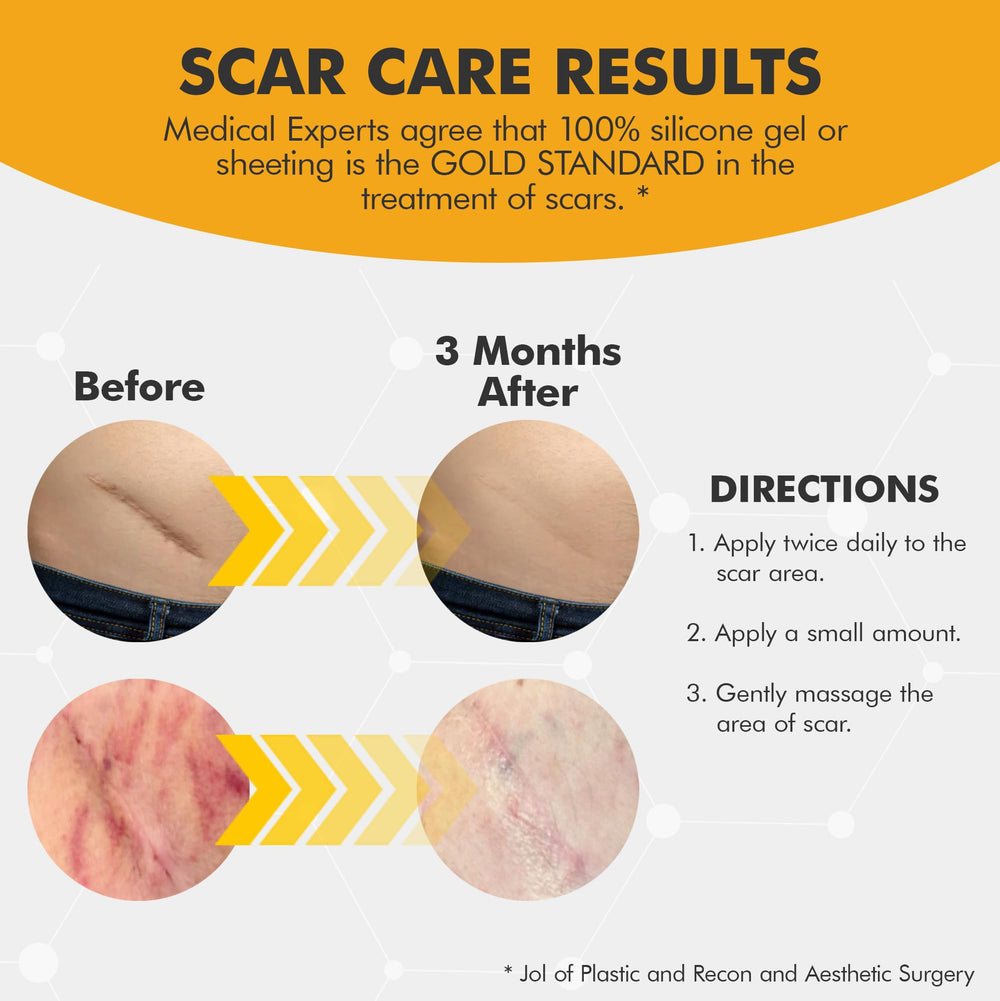 DermAvance Pure Scar Care for surgical scar shows potential improvement over time.