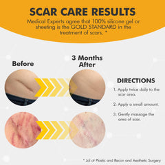 DermAvance Pure Scar Care for surgical scar shows potential improvement over time.