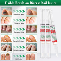 DERMFREE Toe Nail Fungus Renewal Pen under-nail delivery targets the nail bed for healthier-looking nails.