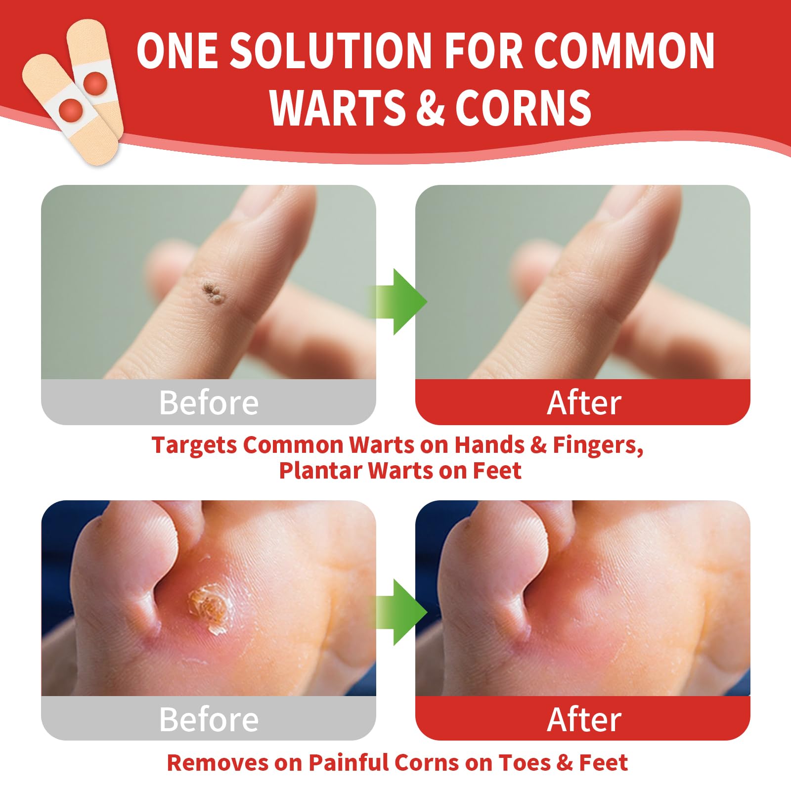 DERMFREE pad demonstrates soft cushioning to reduce foot pressure.