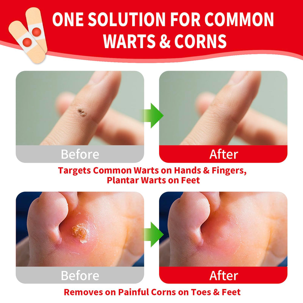 DERMFREE pad demonstrates soft cushioning to reduce foot pressure.