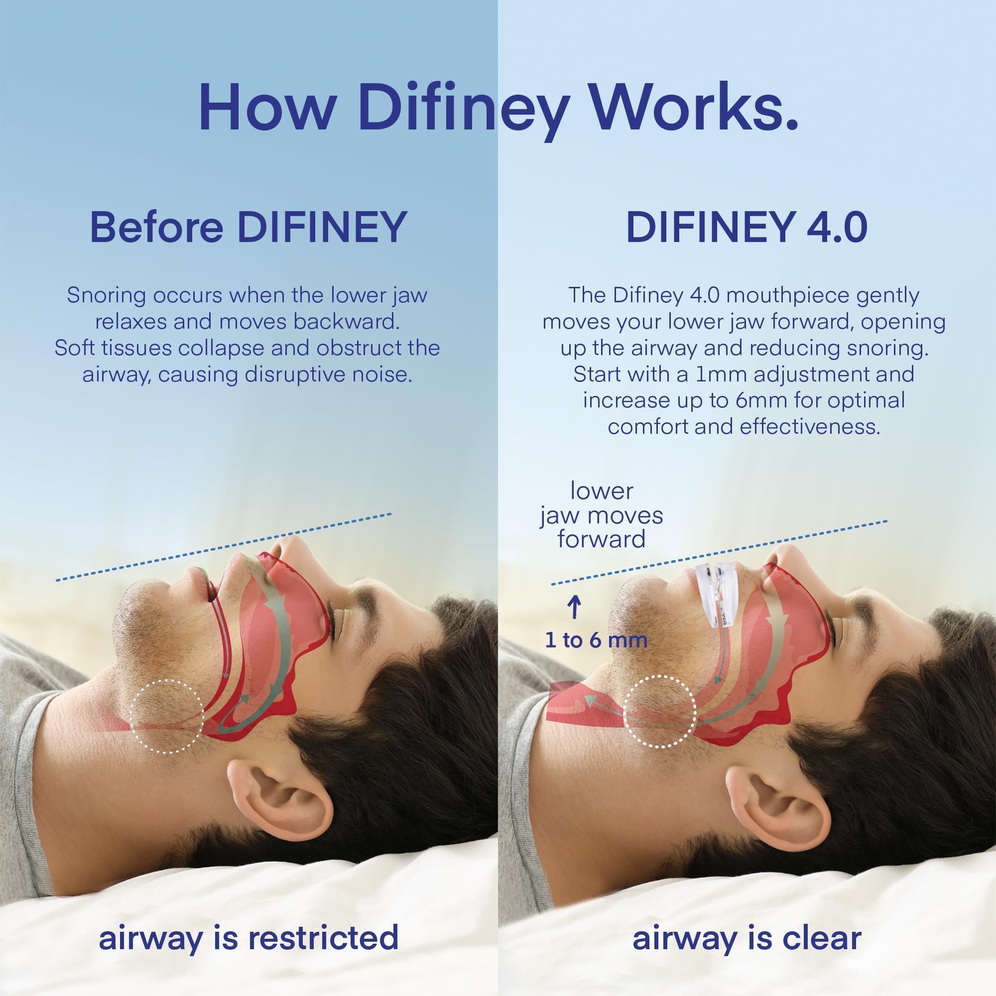 Difiney 4.0 inside view highlighting personalized fit for comfort