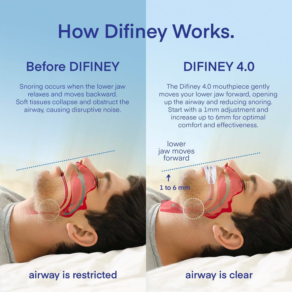Difiney 4.0 inside view highlighting personalized fit for comfort