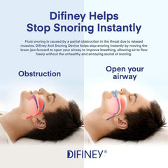 Difiney anti-snoring-device fit closeup shows comfortable bite alignment