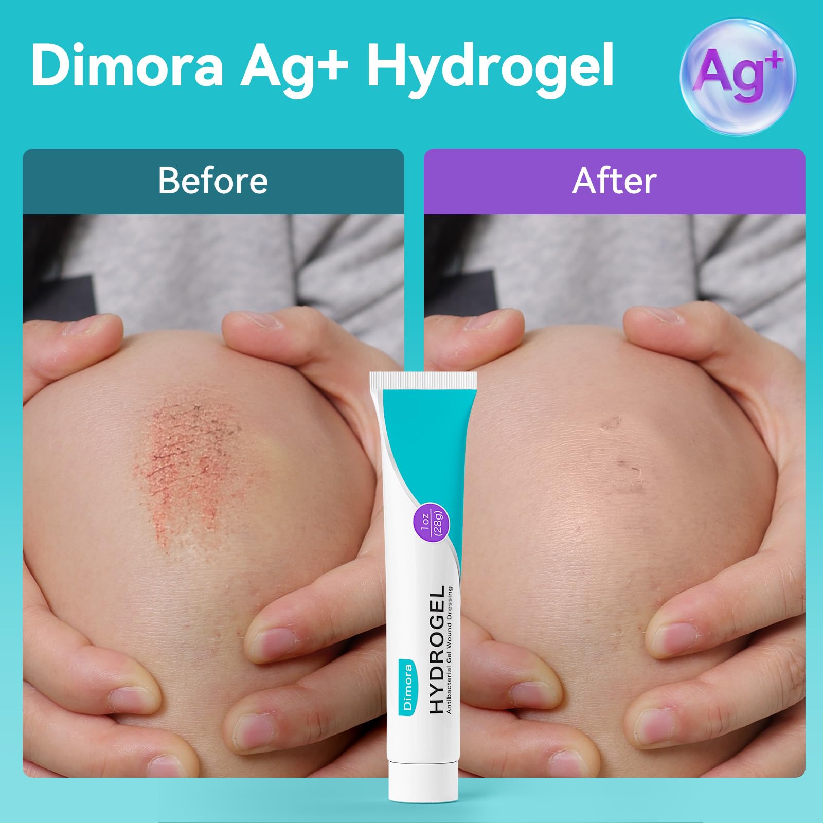 Dimora flexible wound dressing covers burns, scrapes, and cuts