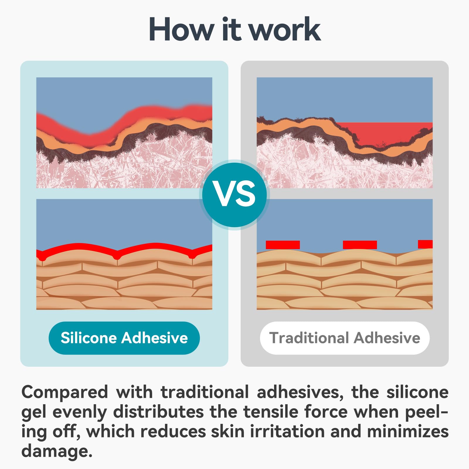 Dimora silicone tape adheres securely to dressing edges for reliable protection.