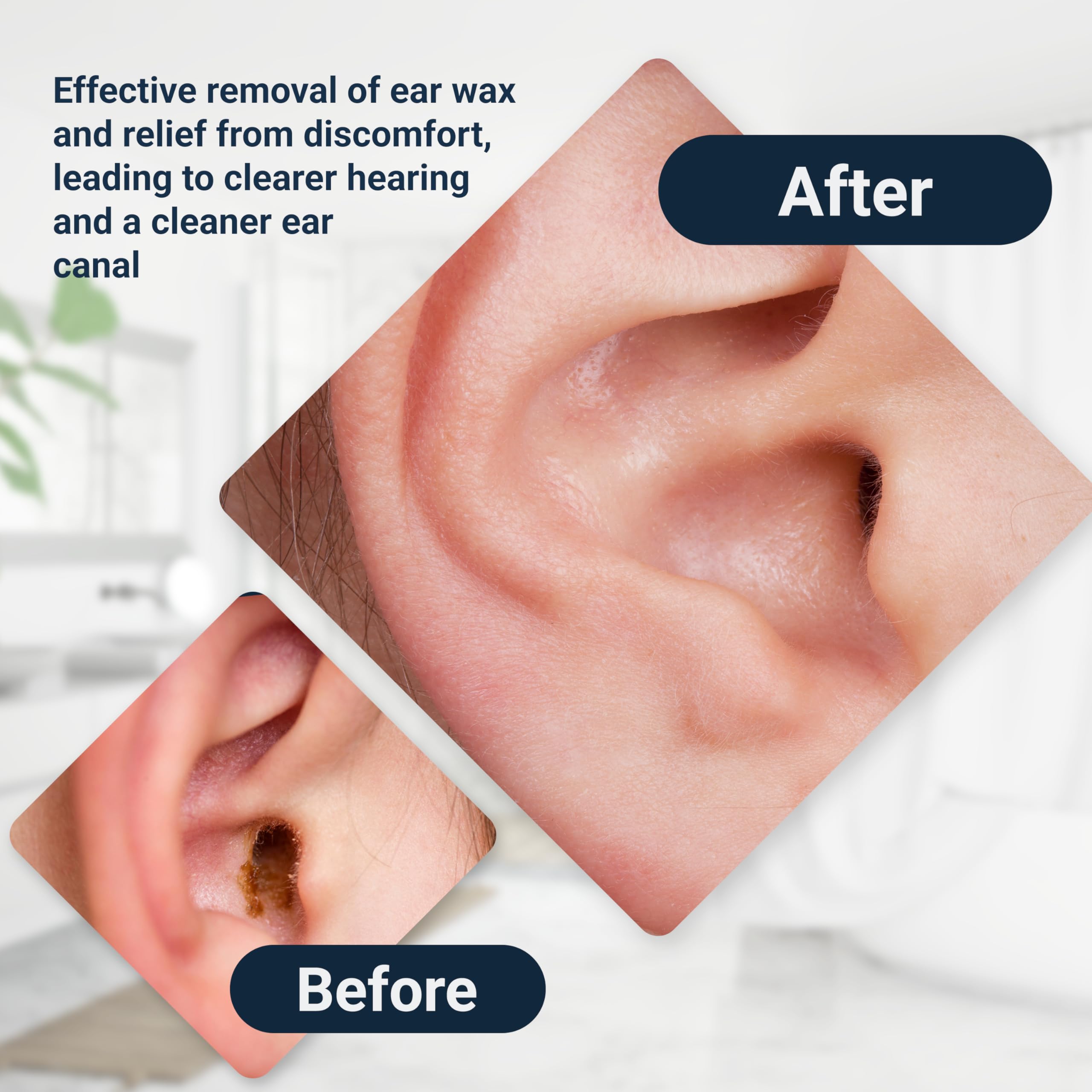 Box packaging of Doctor Easy Elephant Ear Washer Bottle System