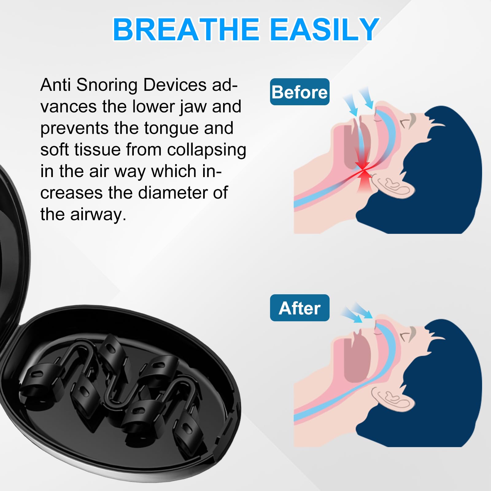 Compact packaging and nasal dilator ready for travel