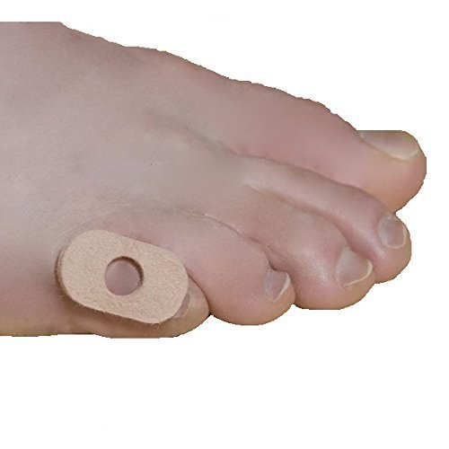 Dr. Jill's corn pads with center aperture protect irritated toes by reducing shoe pressure.