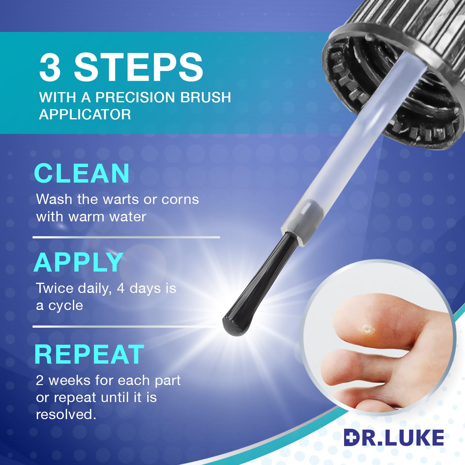 Toe application view of Dr. Luke plantar wart remover on the foot.