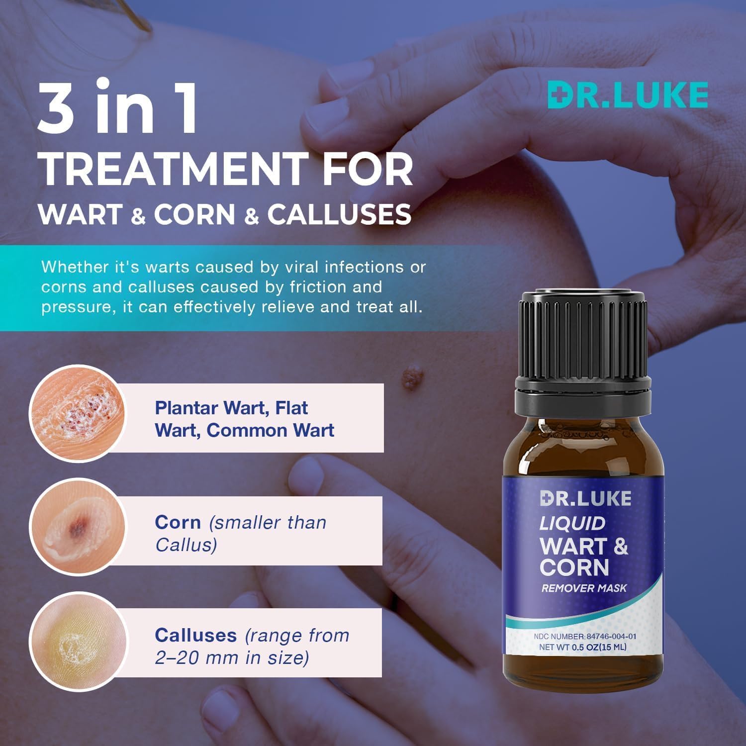 Dr. Luke wart remover 2-pack packaging for home use.
