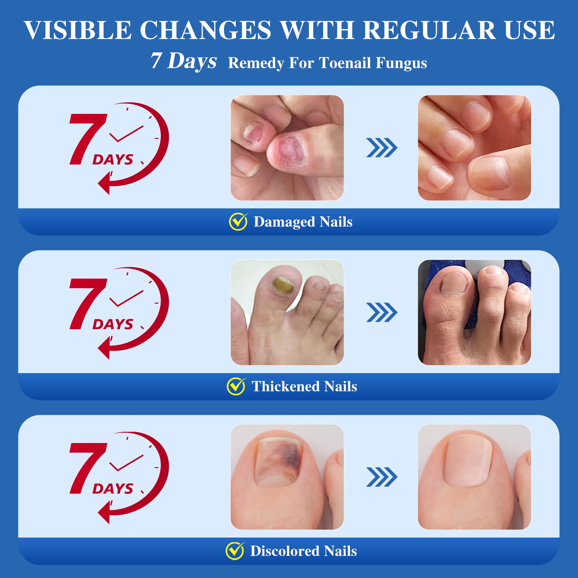 Safe daily-use DR.RAPID for fingernails and toenails for both men and women