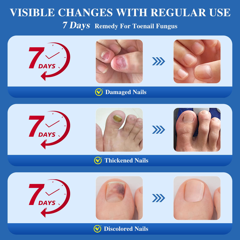 Safe daily-use DR.RAPID for fingernails and toenails for both men and women