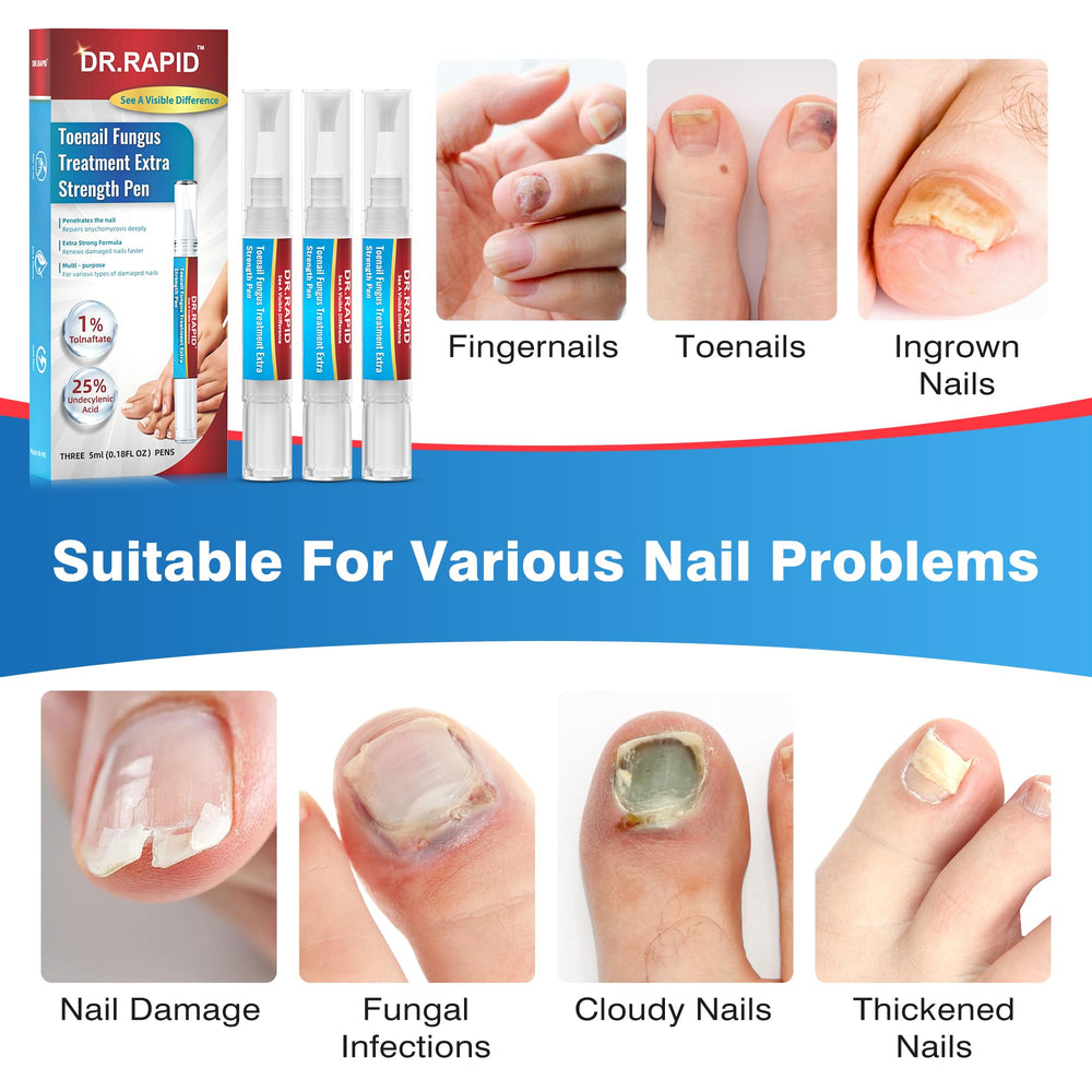 DR.RAPID nail repair pen strengthens damaged nails while addressing fungi.