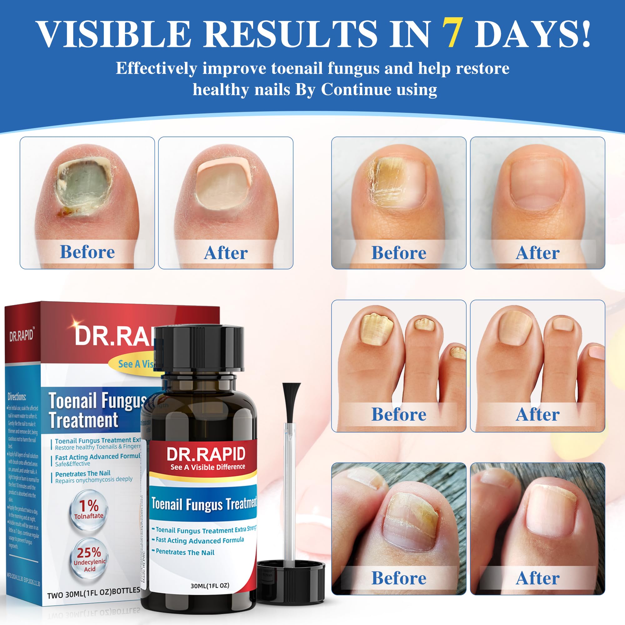 Tea tree oil ingredient in DR.RAPID formula supports natural antifungal action for nails