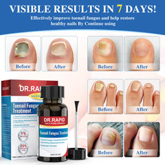 Tea tree oil ingredient in DR.RAPID formula supports natural antifungal action for nails