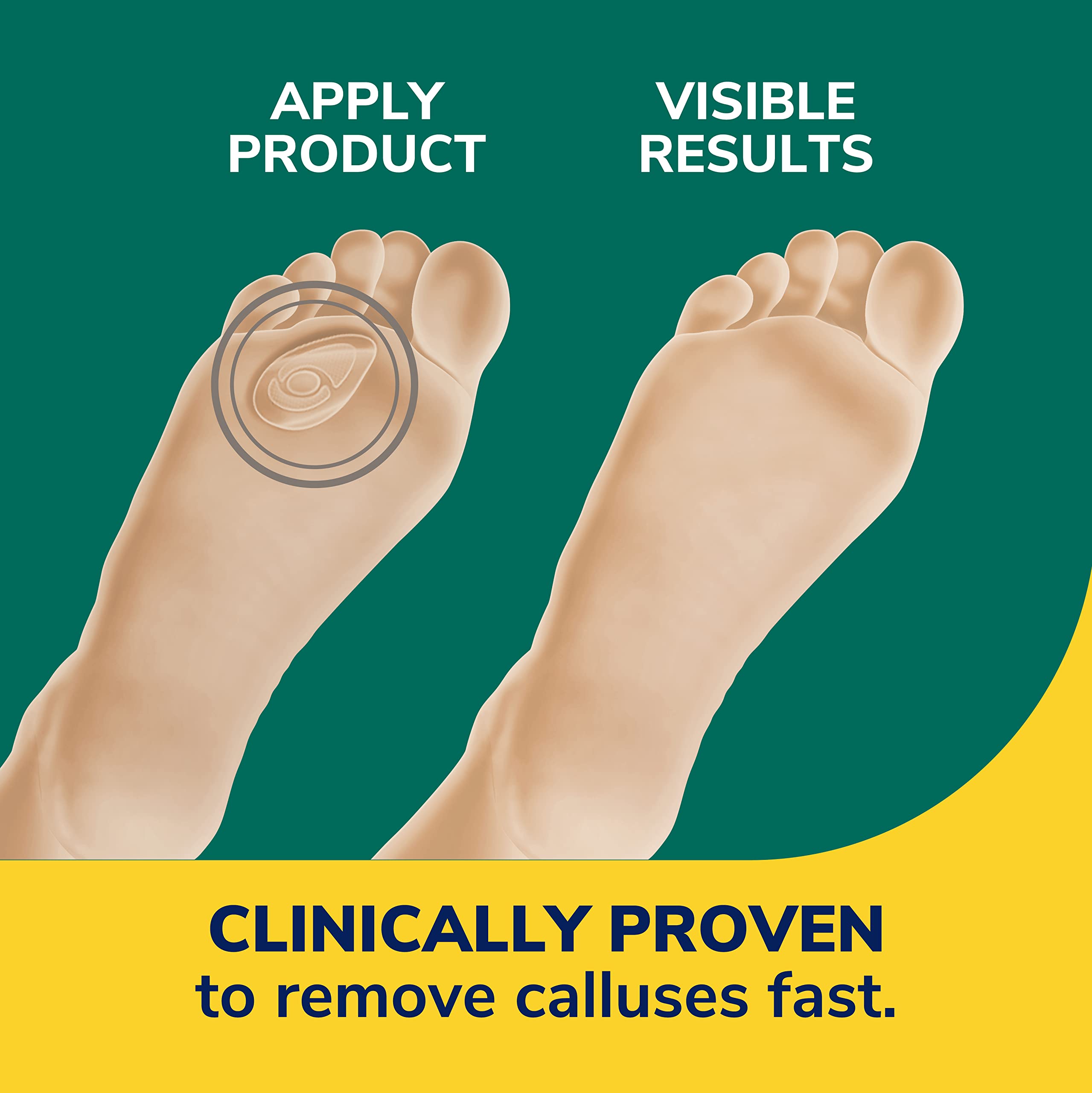 Dr. Scholl's Almohadilla hidrogel: cobertura suave y flexible