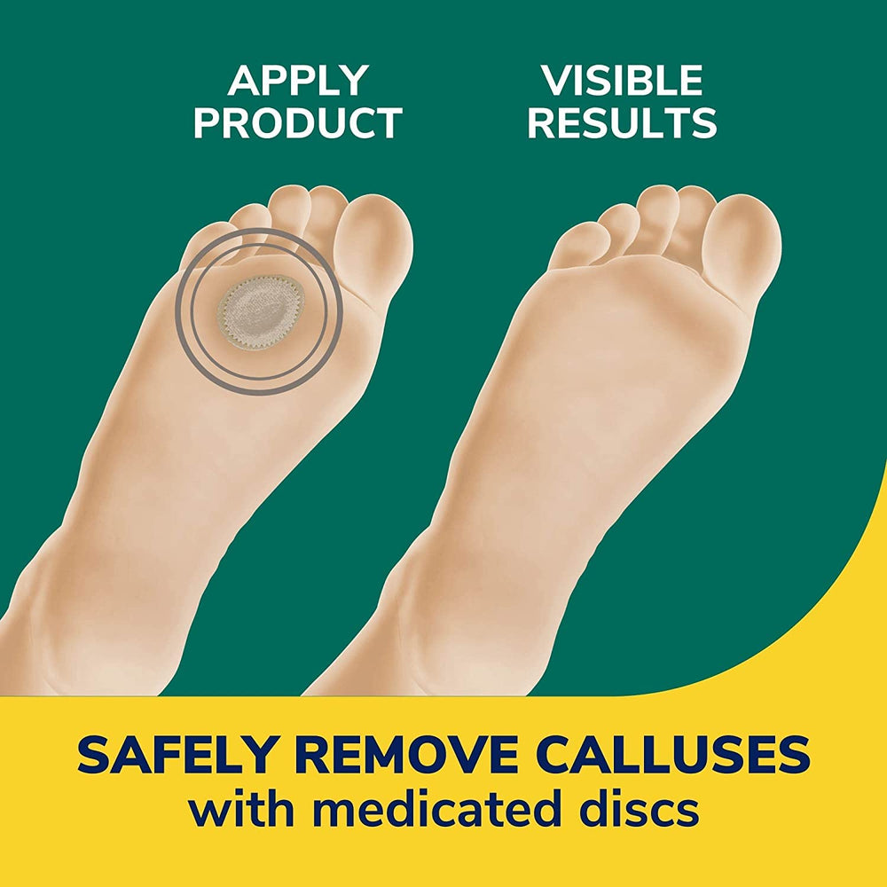 Application view demonstrates easy use and targeted callus care
