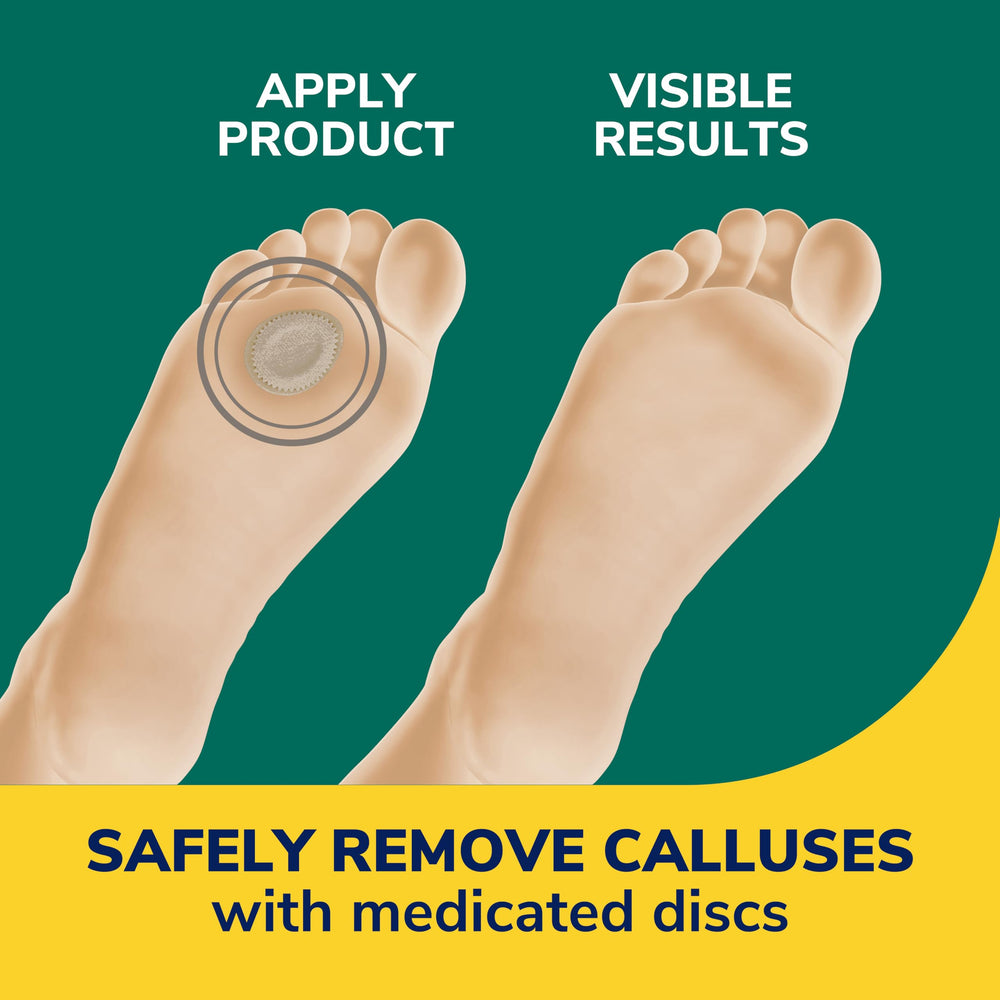 Dr. Scholl's extra-thick cushions protecting calluses from shoe pressure