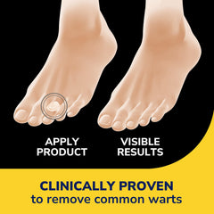 Dr. Scholl's wart remover bandages pack front shows discreet, ready-to-use treatment.