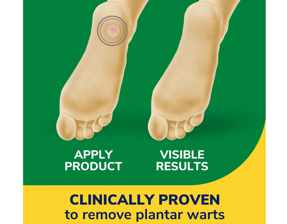 Countertop scene with Dr. Scholl's Clear Away Plantar kit.