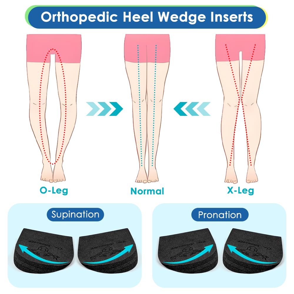 Dr. Shoesert O/X leg changer demonstrates improved leg alignment during movement.