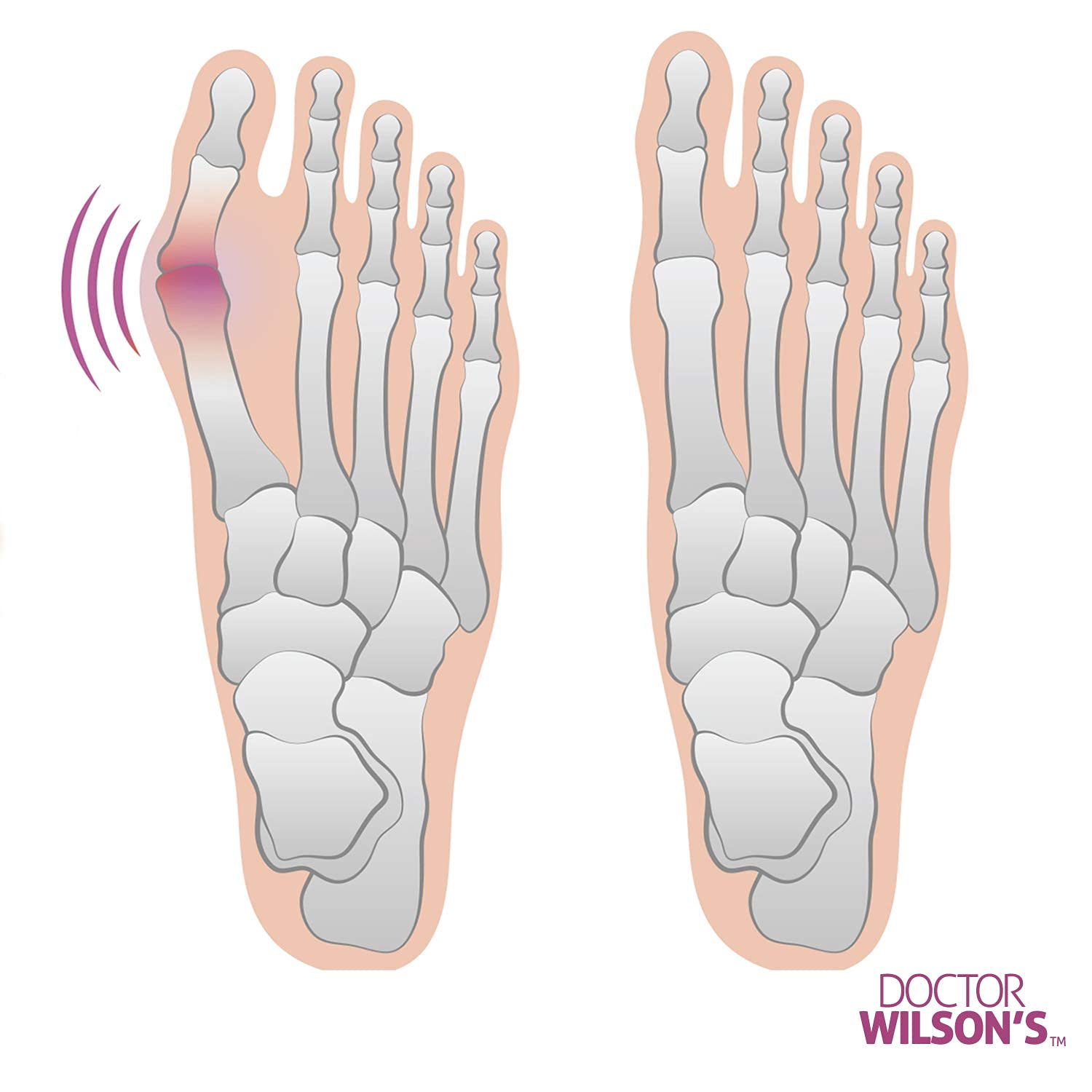 Dr. Wilson almohadilla gel metatarso para mayor amortiguación