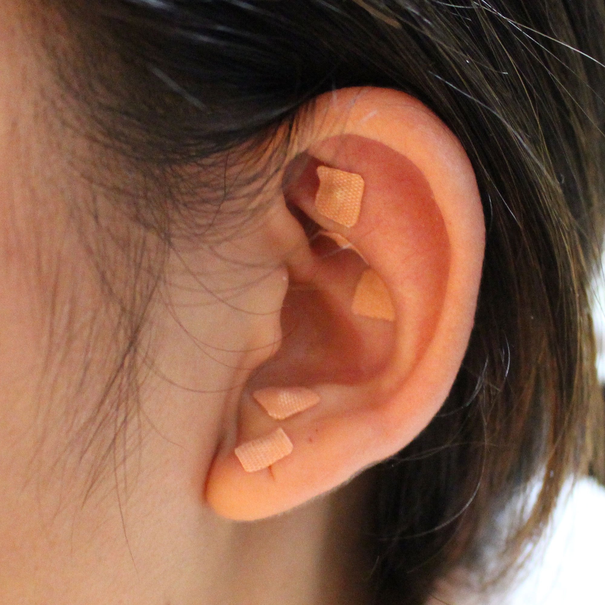 Dragon Acupuncture self-adhesive tapes keep patches secure during wear.
