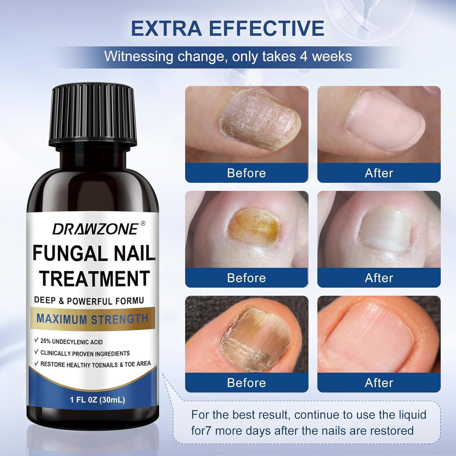 Drawzone dual-action nail renewal improves appearance and strength