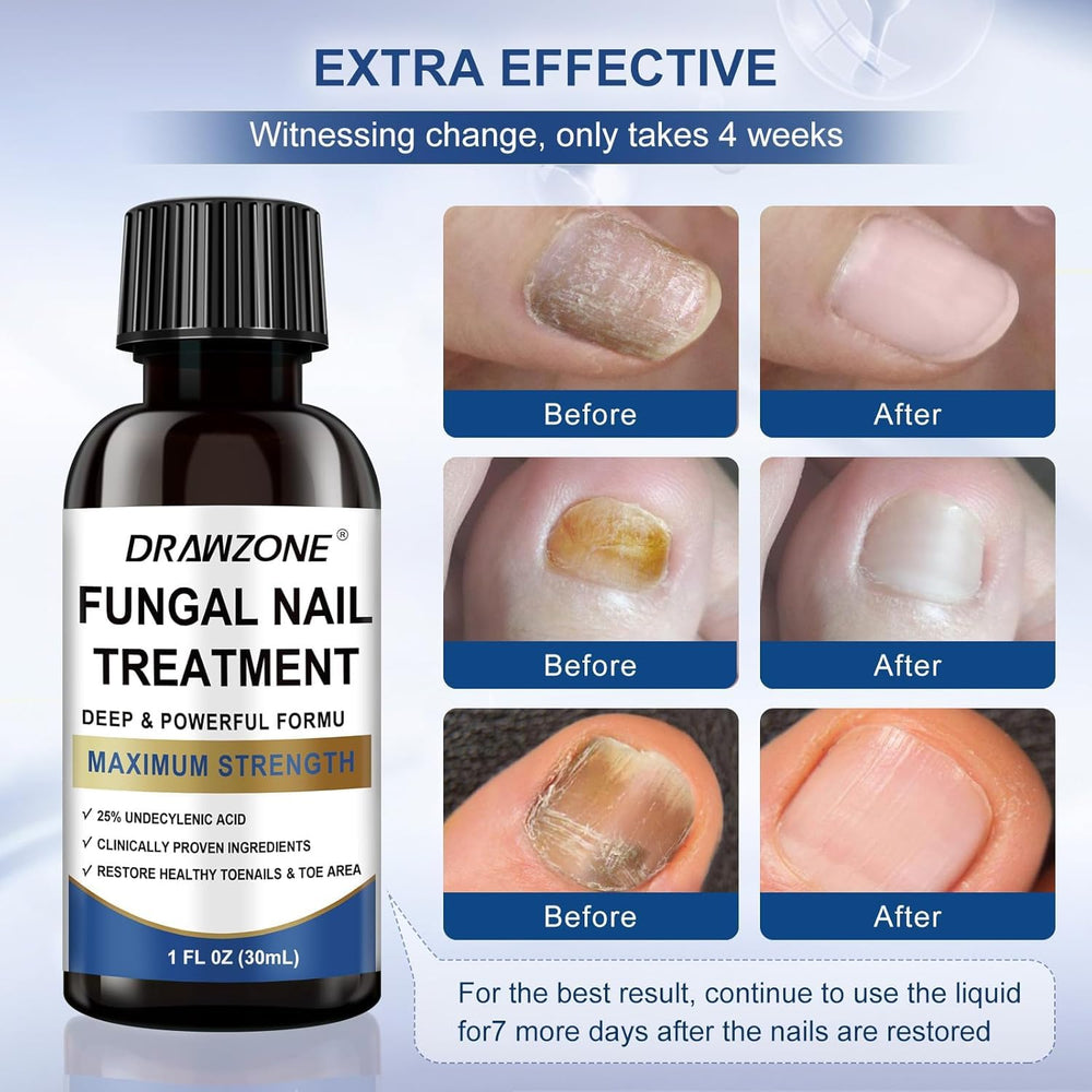 Drawzone dual-action nail renewal improves appearance and strength