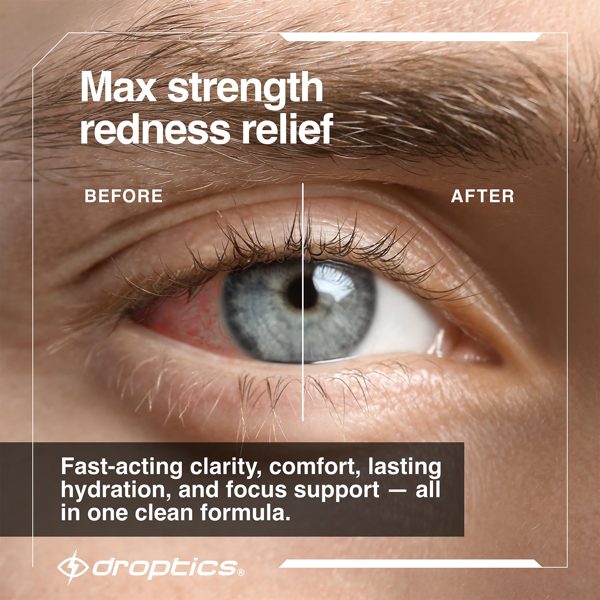 Close-up of Droptics dropper delivering cooling hydration to tired eyes