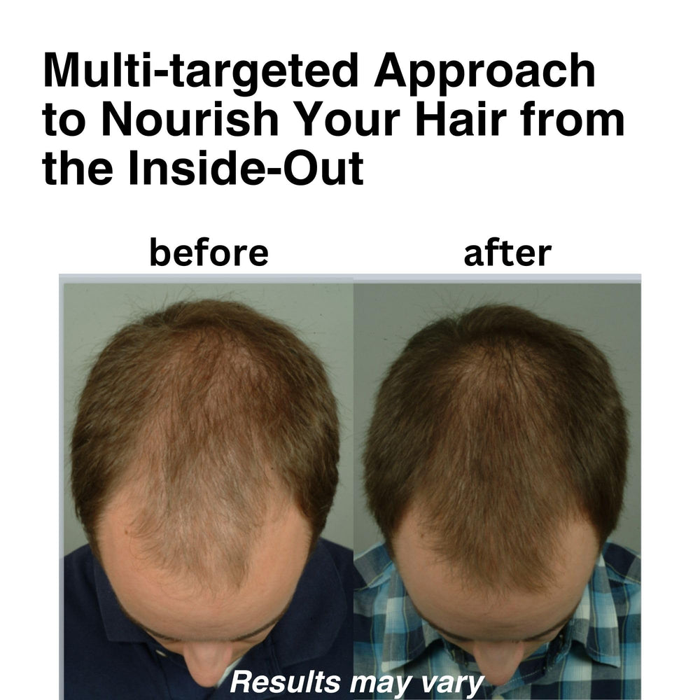 DrSG DHT Blocker capsules highlight natural ingredients for thicker, healthier-looking hair.
