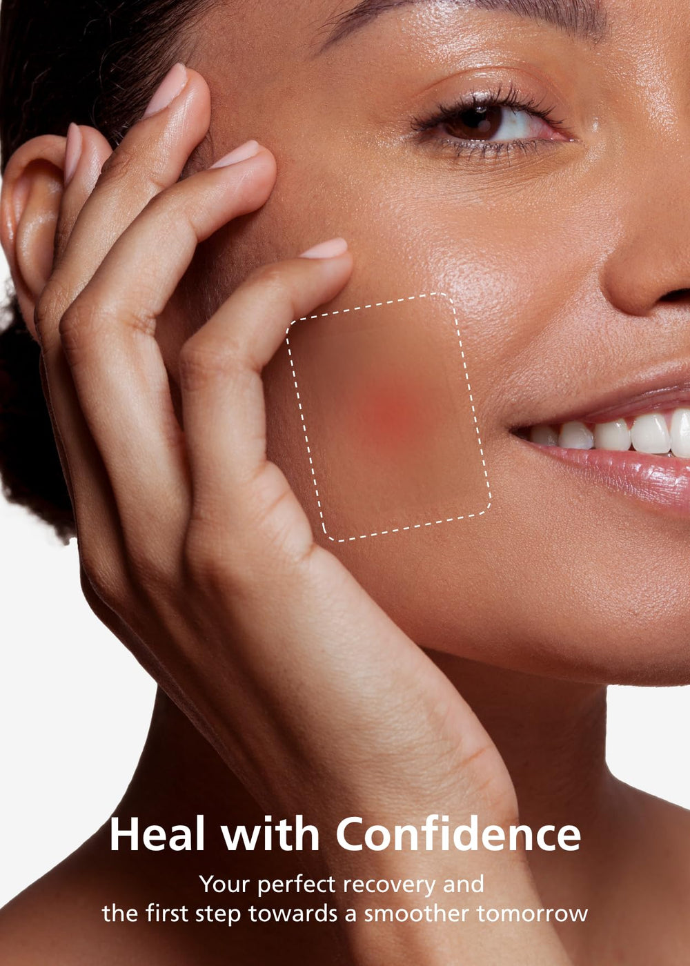Suitable for burns, blisters, or acne care as part of daily wound routines.